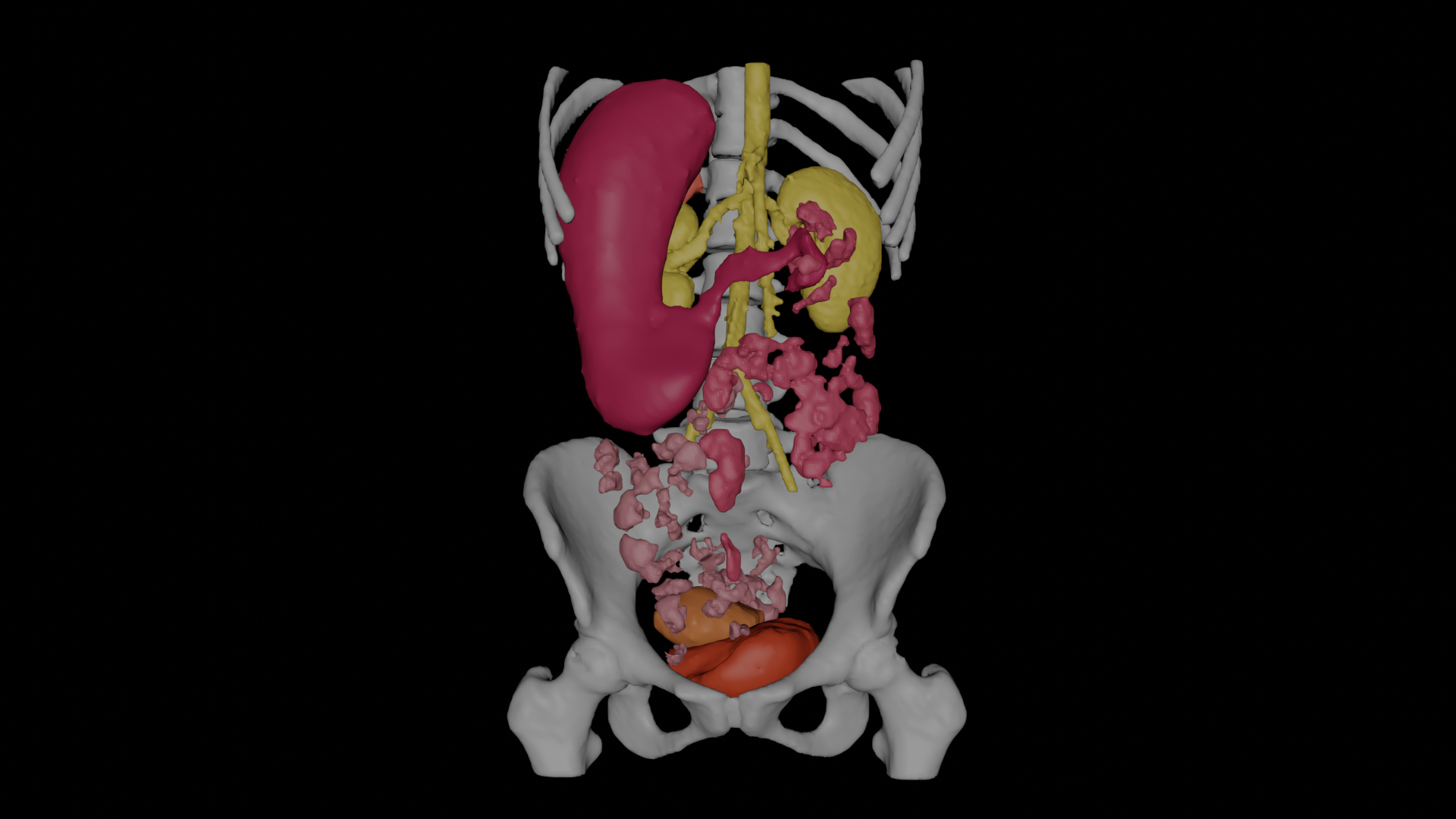 Volumetric medical imaging - 3D anatomy reconstructed from CT data